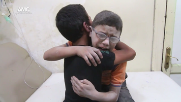 Zwei stabbedeckte Kinder umarmen sich in einem Krankenhaus in Aleppo
