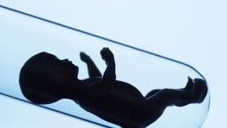 Mit einen unerfllten Kinderwunsch lsst sich Geld verdienen.