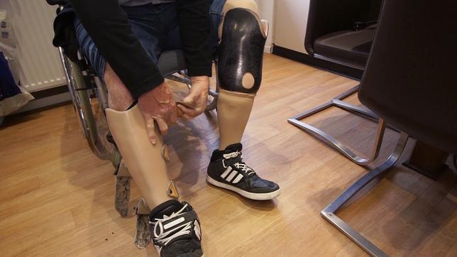 Bild: SR Patient mit Beinprothesen
