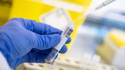 Corona-Test im Labor