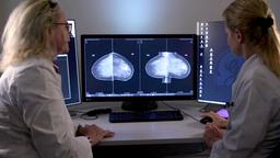 Zwei Wissenschaftlerinnen betrachten Aufnahmen der weiblichen Brust.