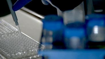 Bild: WDR Pipettieren in Großaufnahme