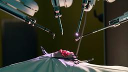 Der Eingriff wird mit einem OP-Roboter durchgeführt.