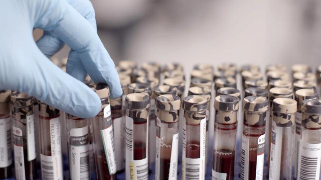 Bild: WDR/Längengrad Filmproduktion GmbH Im mütterlichen Blut befinden sich etwa ab der zehnten Schwangerschaftswoche auch Schnipsel des Erbguts vom Kind.