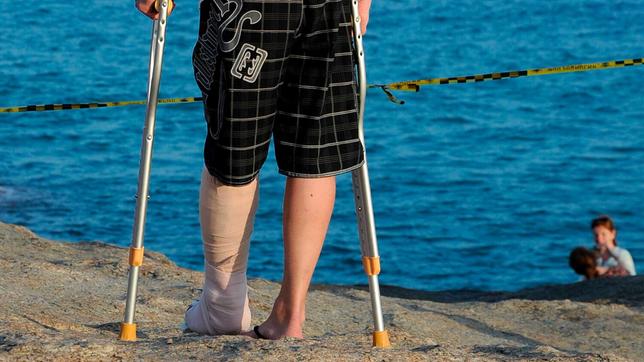 Mann steht mit gebrochenem Bein am Strand.