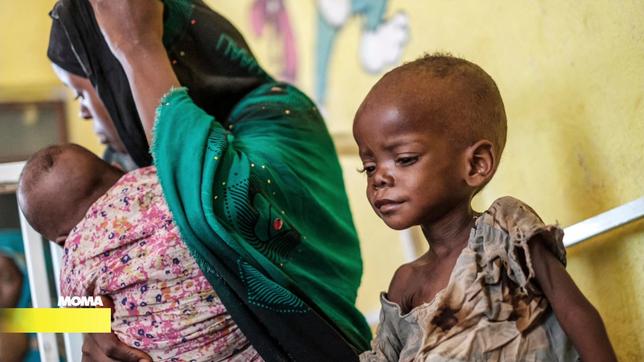 Der Krieg wird auch für Kinder in Somalia zur Katastrophe