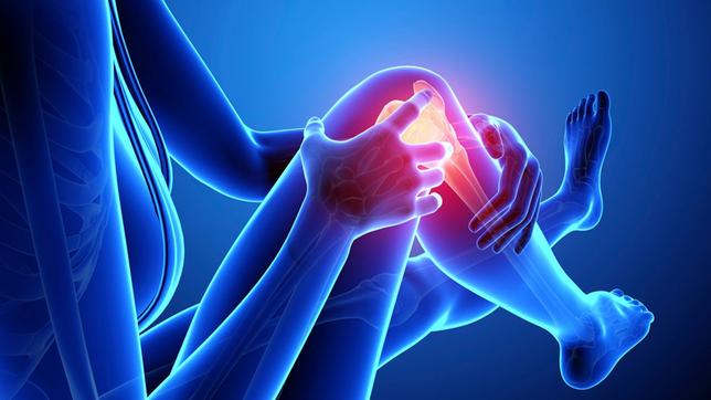 Bild: dpa Arthrose im Knie
