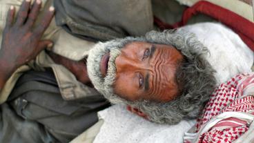 Jemen: Hunger im Jemen – Hilfsorganisationen schlagen Alarm.