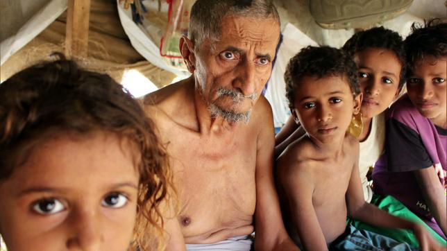 Jemen: Krieg und Hungersnot – und Krankheiten breiten sich aus.
