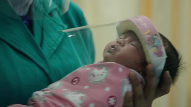Neu geborenes Baby mit Schutzvisier 