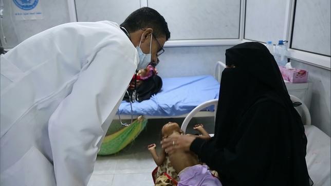 Jemen: Über zwei Millionen Kinder leiden in Jemen an Unterernährung