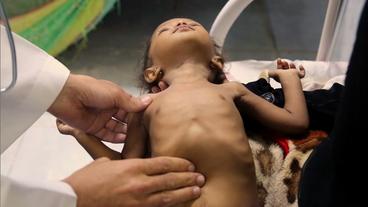 Jemen: 500 Kinder im Jemen wurden im Krieg getötet