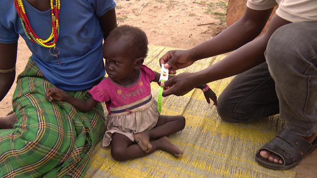 Kenia/Somalia: Unterernährung und Dürre – es droht eine Hungersnot