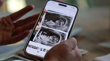 Bild: SWR Ultraschall-Bilder auf Smartphone