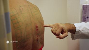 Bild: BR Patient beim Allergietest