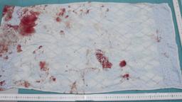 Blau-weiß kariertes Handtuch mit Blut von der Geburt.