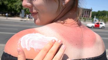 Bild: dpa/Stephanie Pilick Sonnencreme