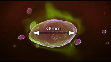 Bild: SWR Mikroplastik