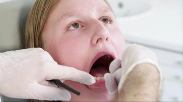 Wie lange hat man Schmerzen wenn man eine feste Zahnspange bekommen hat?