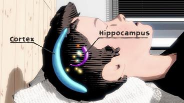 Zechnung eines Kopfes mit den Arealen Hippocampus und Cortex.