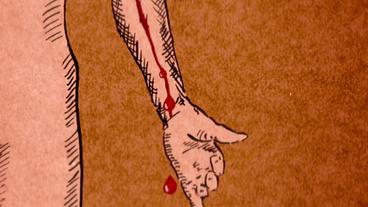 Bild: HR Aus einem Arm tropft Blut (Zeichnung)