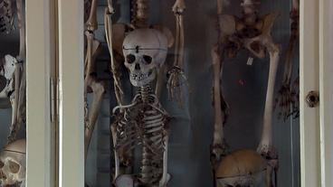 Bild: BR Alte Skelette von Kindern und Erwachsenen in der Anatomischen Sammlung der Uniklinik Jena