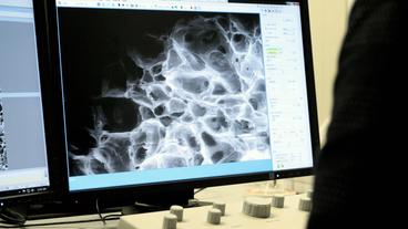 Bild: WDR Lendlein betrachtet ArcGel Schaum