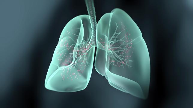 Lunge gefüllt mit roten Sauerstoff-Molekülen.