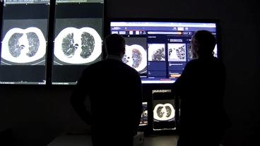 Zwei Männer stehen vor Bildschirmen, auf denen Aufnahmen des menschlichen Körpers zu sehen sind.
