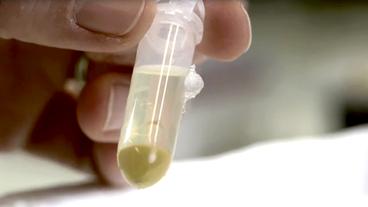 Bild: BR Pollen mit weiteren Substanzen