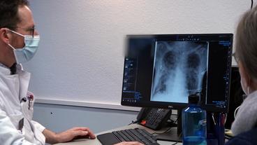 Prof. Siegbert Rieg und Patientin betrachten Röntgenbild der Lunge.