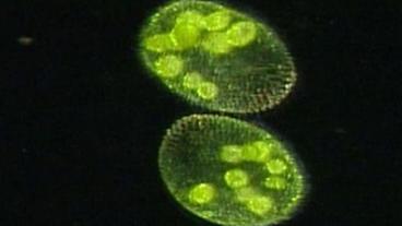 Grünleuchtende Mikro-Algen unter dem Mikroskop