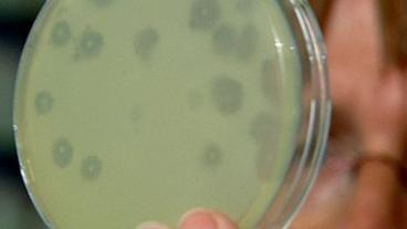 Bild: WDR Wissenschaftlerin hält Petrischale vor Augen