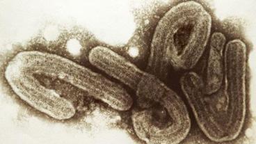 Ebola-Virus