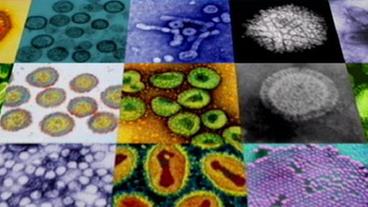 Bilder von verschiedenen Viren