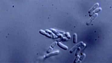 Bakterien unter dem Mikroskop
