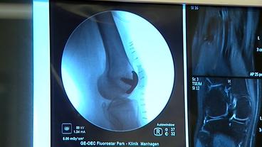 Bild: NDR Röntgenbild des Implantats
