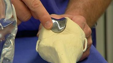 Bild: NDR Knie-Metallimplantat