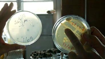Zwei Petrischalen mit Bakterienabstrichen