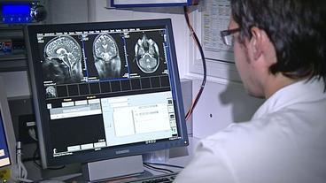 Auf einem Computerbildschirm wird das Magnetresonanztomographenbild eines Gehirns gezeigt