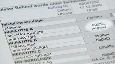 Auflistung der Analyse des Plasmas