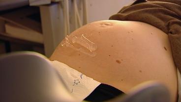 Bild: NDR Ultraschalluntersuchung