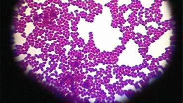 Bakterien durch Mikroskop