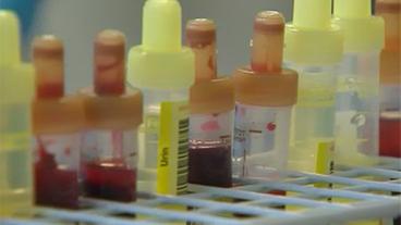 Bild: SWR Blut- und Urinproben in Röhrchen