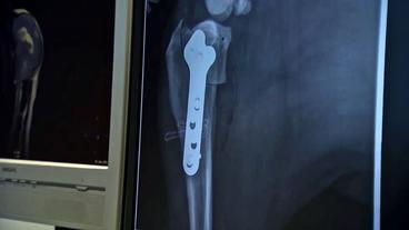 Röntgenbild des operierten Hundebeins