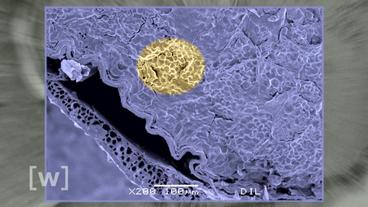 Mikroskopische Aufnahme eines Gerstenkorns