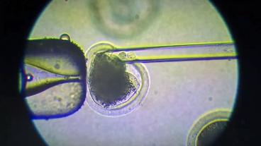 Mikroskopische Aufnahme: Einer Eizelle wird ein Zellkern injiziert