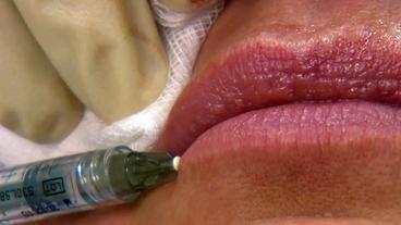 Bild: BR Einer Frau wird die Unterlippe unterspritzt