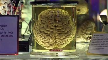 Menschliches Gehirn in Formaldehydglas im Museum