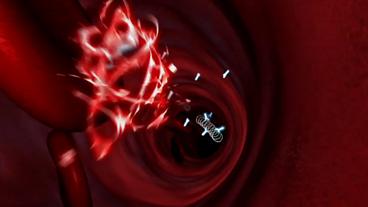 Bild: SWR Animation zeigt wie eine Borrelie explodiert